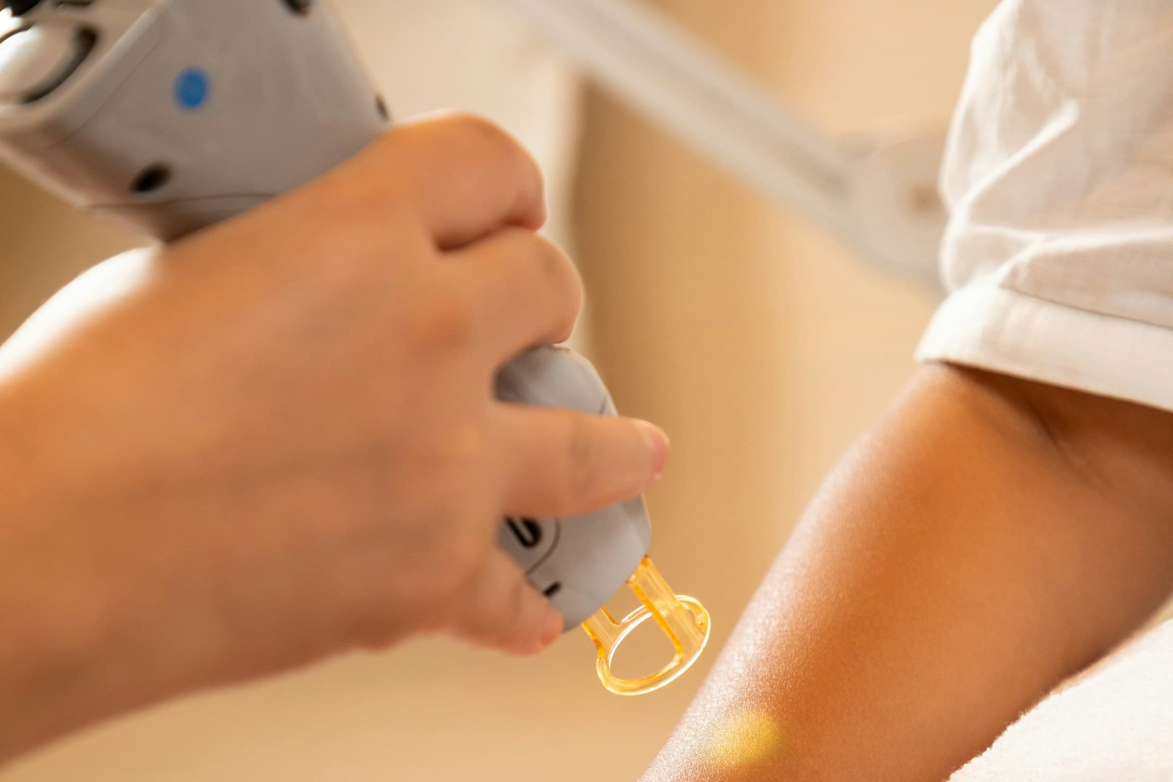 Close-up of a laser hair removal device with a gold glow being applied to a forearm during a dermatology procedure
